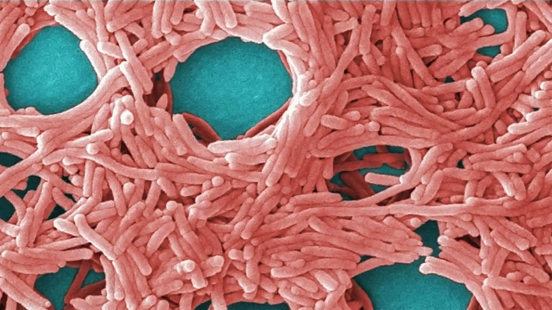 legionella